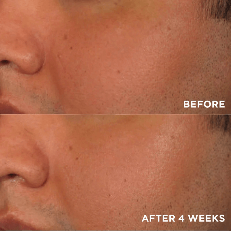Image Skincare Brightening Boost Kit