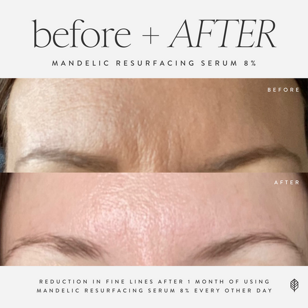 Mandelic Resurfacing Serum