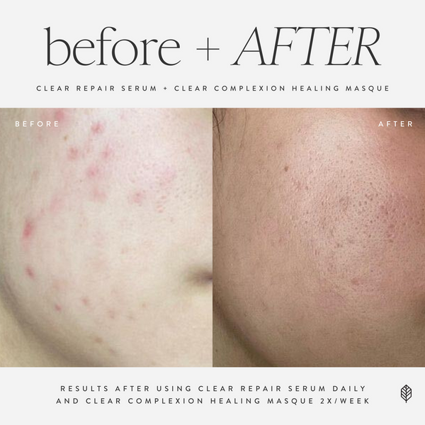 Clear Repair Serum